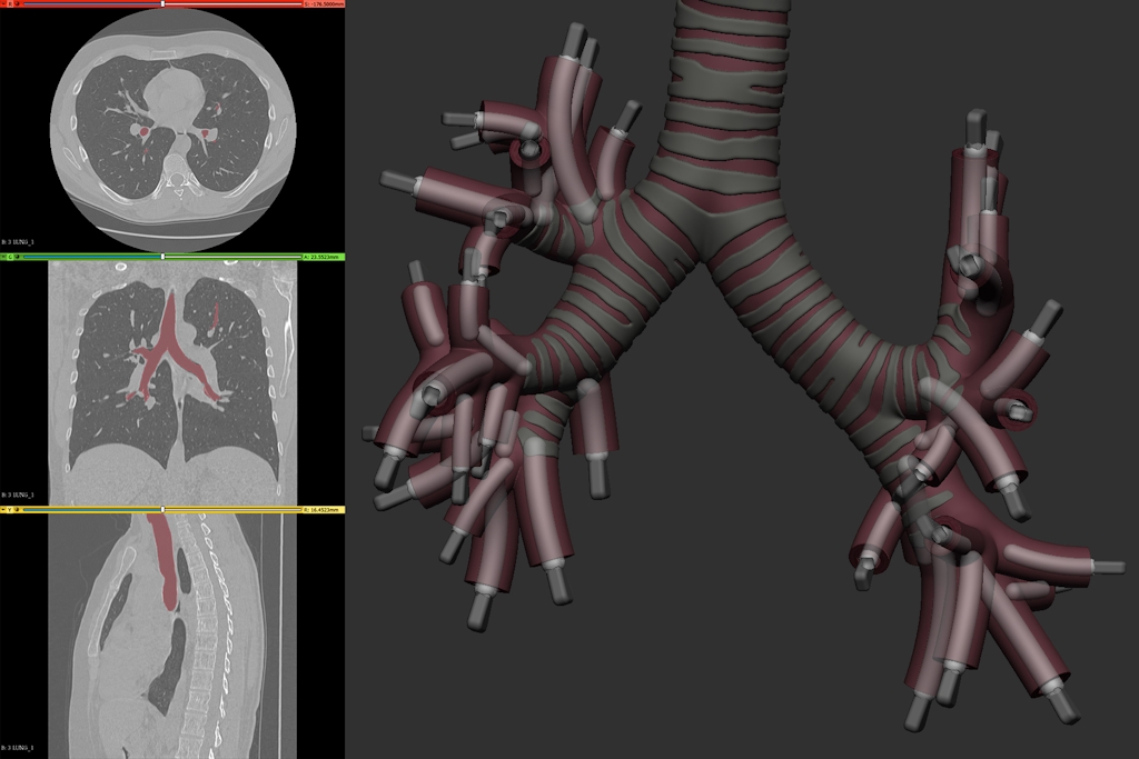 Screenshot from 3D slicer and ZBrush showing the creation of the trachea model from scan data.